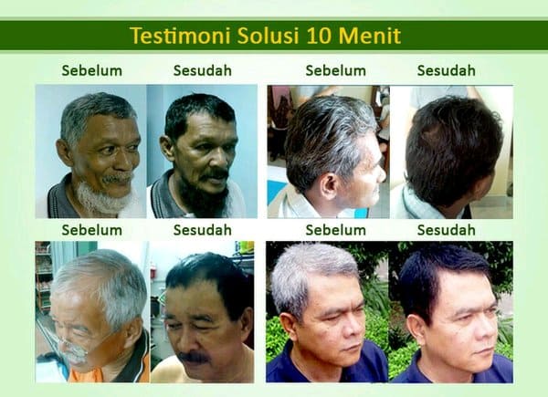 Beranda 6 sebelum dan sesudah pakai beyondblack